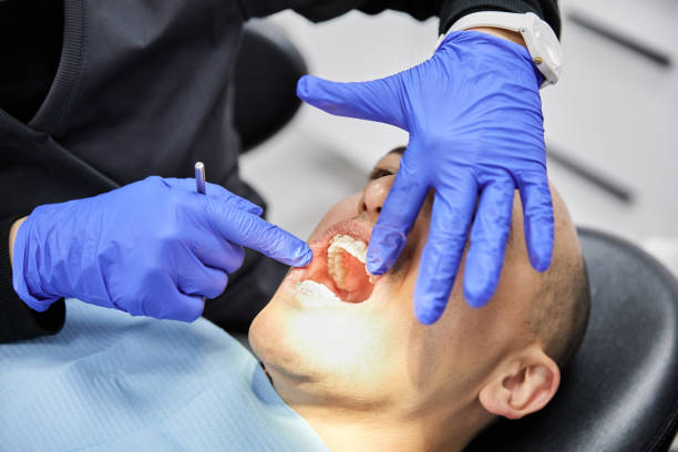 Best Emergency Gum Pain Relief  in Hidden Valley Lake, CA